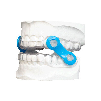 dental appliance for the treatment of sleep apnea