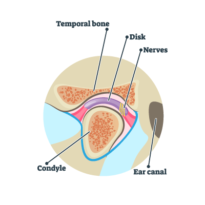 temporomandibular joint dysfunction