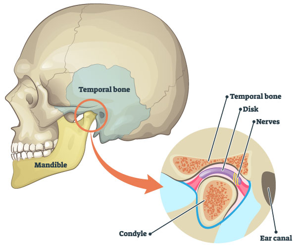 temporomandibular joint dysfunction